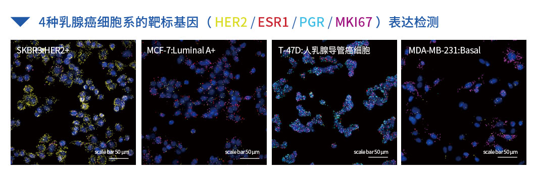4种乳腺癌细胞系的靶标基因_画板 1.jpg
