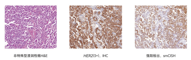 SEERNA®-CISH-RNA-显色原位杂交试剂盒折页-最终-06.jpg