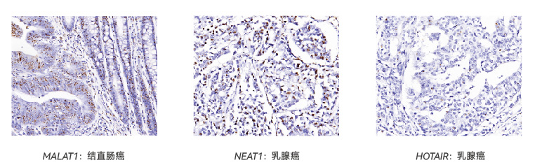 SEERNA®-CISH-RNA-显色原位杂交试剂盒折页-最终-05.jpg