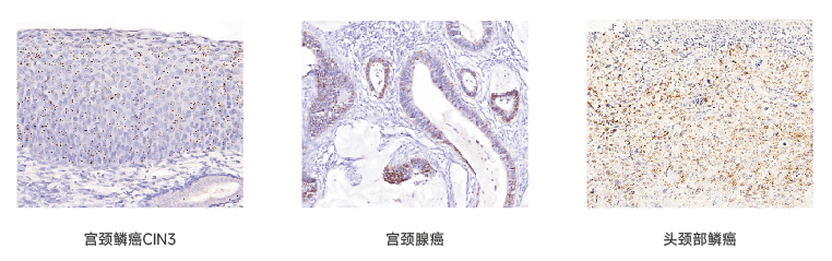 SEERNA®-CISH-RNA-显色原位杂交试剂盒折页-最终-04.jpg